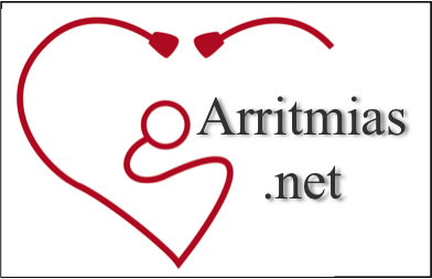 Arritmias.net